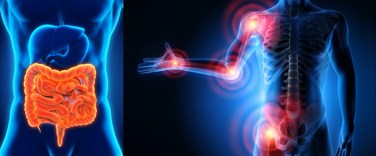 ESISTE UN ASSE INTESTINO-ARTICOLAZIONI?